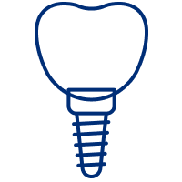 All-on-4 Dental Implants