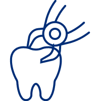 Tooth Extraction
