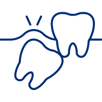 Wisdom Teeth Removal